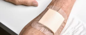 Jakie opatrunki stosować na zakażone rany? - zdjęcie główne