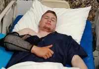 Młody bramkarz po operacji. Kiedy wróci do gry? - zdjęcie główne