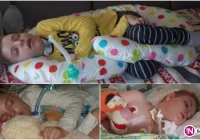 Potrzeba pieniędzy na kosztowne lekarstwa dla 13-letniego Mikołaja - zdjęcie główne