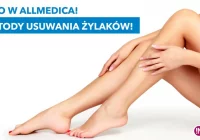 Przełomowe metody leczenia żylaków w ALLMEDICA - zdjęcie główne