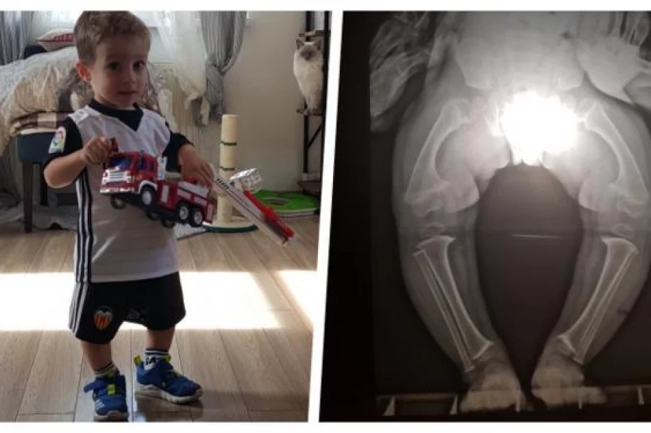 Zbyt wiele bólu, zbyt wiele upadków - trzeba uratować nogi Jurka! - zdjęcie 3