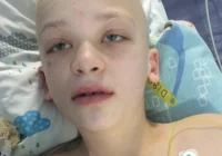 Piotruś już po operacji. Potrzebna pomoc na jego leczenie - zdjęcie główne