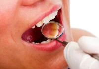 Naukowcy: nadmiar komputerów to większy problem z próchnicą - zdjęcie główne