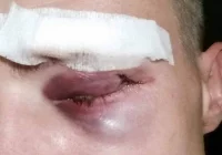 Mężczyzna na ulicy pobity przez obcokrajowców - zdjęcie główne