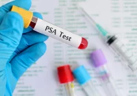 Szpital zaprasza na bezpłatne badania! - zdjęcie główne