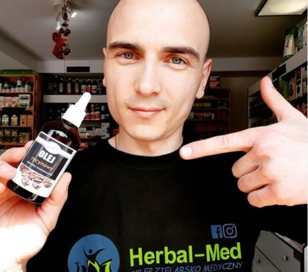 Rozpuszcza toksyczne złogi - GUZY -CYSTY - TORBIELE - TŁUSZCZAKI - KASZAKI- - Zdjęcie główne