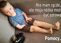 Operacja może odbyć się w Polsce. Koszty mniejsze, ale pomoc wciąż potrzebna - zdjęcie główne