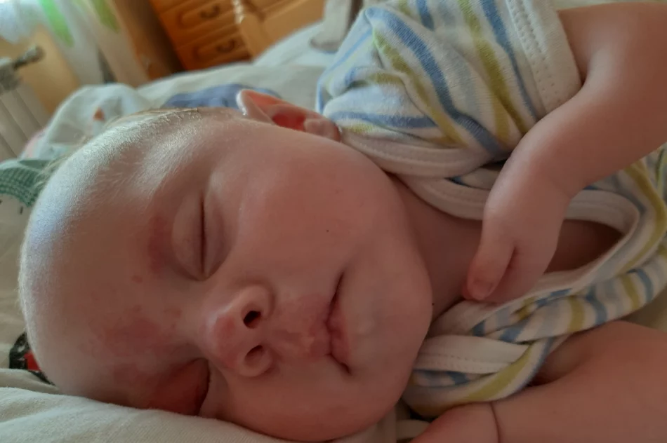 Rodzice potrzebują wsparcia w walce o sprawność i samodzielność ich córeczki - zdjęcie 3