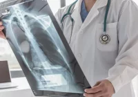 Eksperci: osoby z problemami układu oddechowego muszą zachować szczególną czujność podczas epidemii - zdjęcie główne
