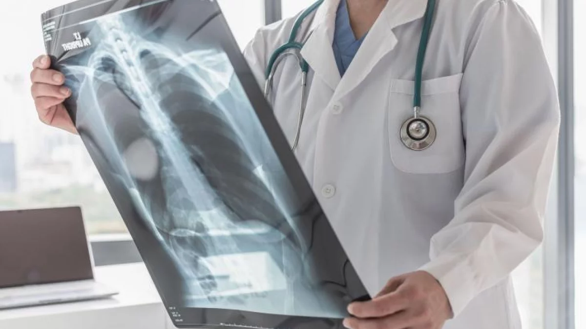 Pulmonolog: liczba przypadków raka płuc w Polsce nie maleje; winne są nowe wyroby nikotynowe