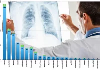 34 nowe przypadki w województwie, 4 w powiecie - komunikat o sytuacji epidemiologicznej w Małopolsce - zdjęcie główne