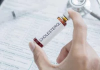 Prawie 20 mln Polaków ma zbyt wysoki poziom cholesterolu - zdjęcie główne