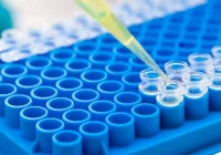 Czym różnią się między sobą testy na koronawirusa - zdjęcie główne