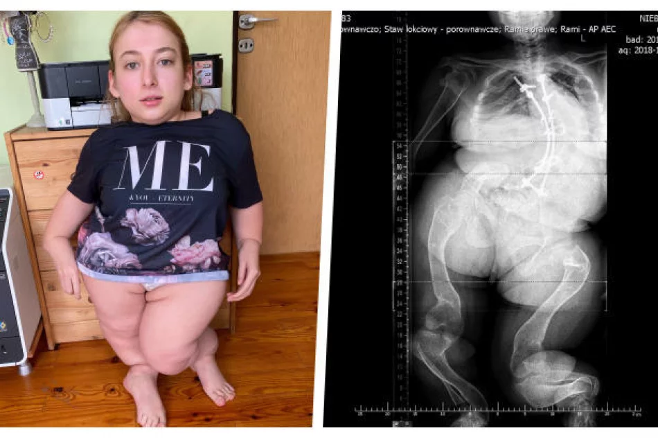 Diana w Dzień Dobry TVN. Zbiórka na jedną z najtrudniejszych operacji w Polsce trwa - zdjęcie 2