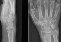 Bezpłatne badania w Galicyjskim Miasteczku Zdrowia już w najbliższą niedzielę - zdjęcie główne