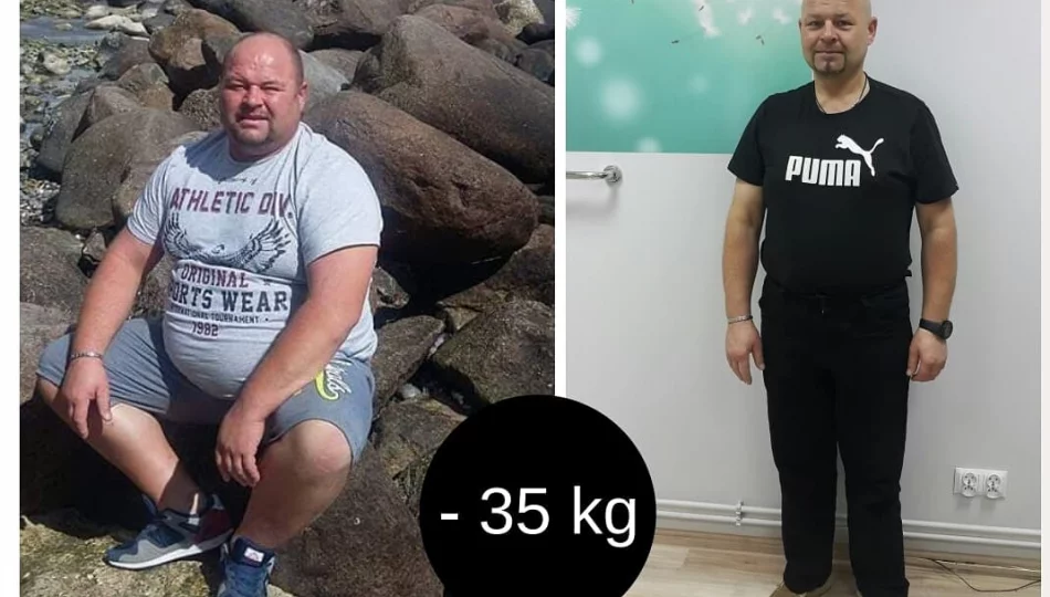 Pan Grzegorz schudł 35kg z Projekt Zdrowie!  - zdjęcie 1