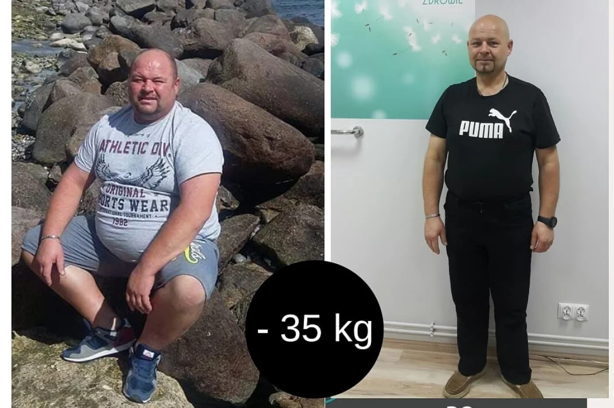 Pan Grzegorz schudł 35kg z Projekt Zdrowie! 