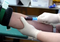 Nie każdy „dobry” cholesterol jest korzystny dla zdrowia - zdjęcie główne