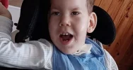 Rzadka choroba osłabia mięśnie dwuletniego Szymona - zdjęcie 2
