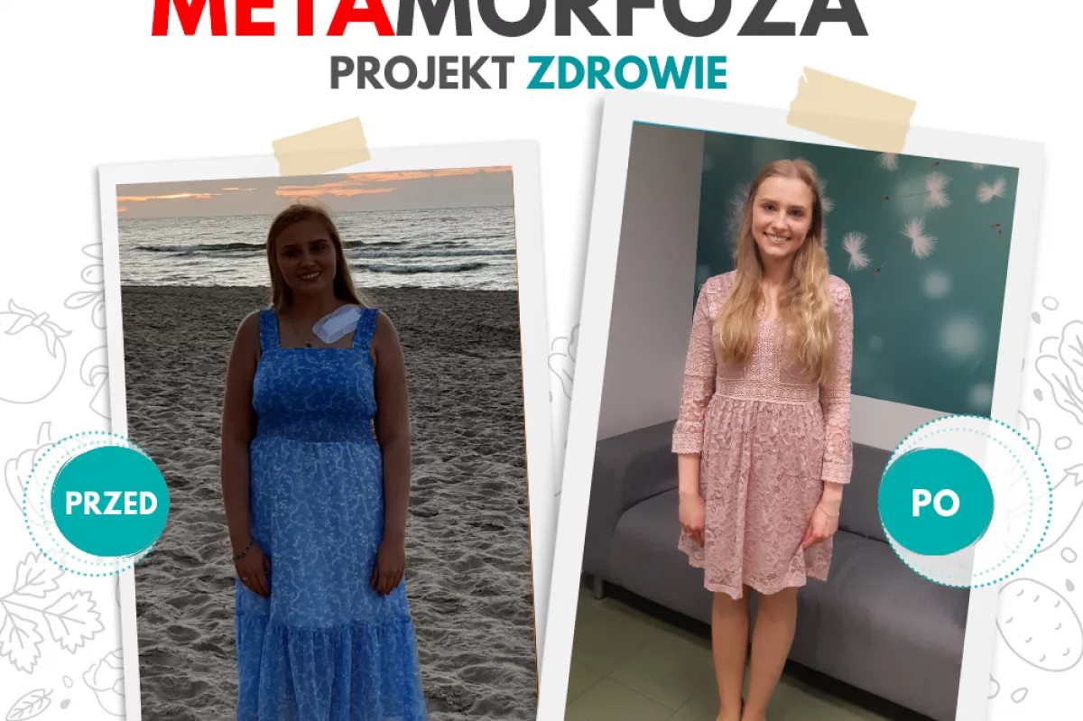 Pani Sylwia schudła 14kg w Projekt Zdrowie!
