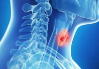 COVID-19 a dolegliwości tarczycy - zdjęcie główne