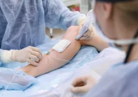 ALLMEDICA - Eksperci w usuwaniu żylaków - zdjęcie główne