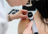 Objawy dermatologiczne występują u ok. 20 proc. chorych na COVID-19 - zdjęcie główne