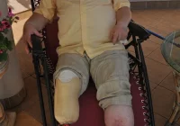 Podstaw nie było: stopień umiarkowany - zdjęcie główne