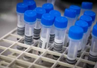 Ekspert: badanie faktycznej odporności człowieka nie jest proste - zdjęcie główne