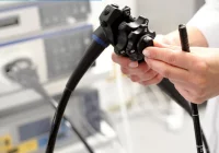 Wyjątkowe warunki darmowego badania kolonoskopowego w znieczuleniu - zdjęcie główne