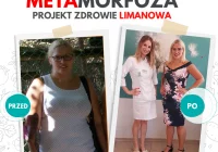 Pani Dominika schudła 23 kg w 5 miesięcy w Projekt Zdrowie! - zdjęcie główne