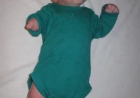 Pojawiła się nadzieja - będzie mógł chodzić - zdjęcie główne