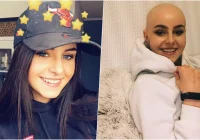 22-letnia Patrycja chce znów szczerze się uśmiechać - potrzebne wsparcie - zdjęcie główne