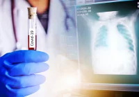 33 nowe zakażenia i  4 przypadki śmiertelne w powiecie. "Trzeba się spodziewać systematycznych wzrostów zakażeń" - zdjęcie główne