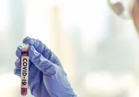 W Małopolsce rośnie liczba zachorowań na covid i inne choroby zakaźne - zdjęcie główne