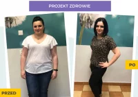- 30 kg w Centrum Dietetycznym Projekt Zdrowie  - zdjęcie główne