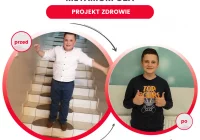 Maksymilian - wyjątkowy chłopiec – wyjątkowe 10 kg mniej! - zdjęcie główne