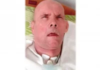 Pomóż obudzić Stanisława po fatalnych skutkach zachłyśnięcia - zdjęcie główne