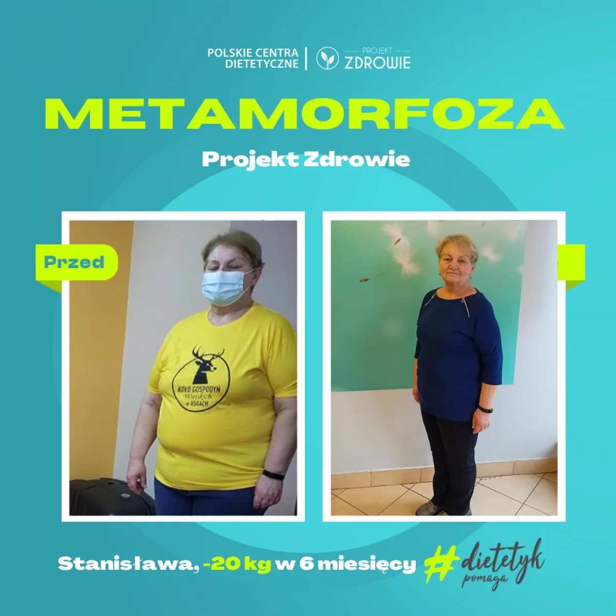 Kolejna metamorfoza w Projekt Zdrowie! Pani Stanisława schudła ponad 20 kg!