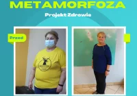 Kolejna metamorfoza w Projekt Zdrowie! Pani Stanisława schudła ponad 20 kg! - zdjęcie główne