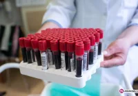 U 33 osób wyniki przekroczyły normy - zdjęcie główne