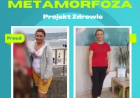 Poznajcie Panią Zuzannę, która schudła 10 kg w Gabinecie Projekt Zdrowie. - zdjęcie główne