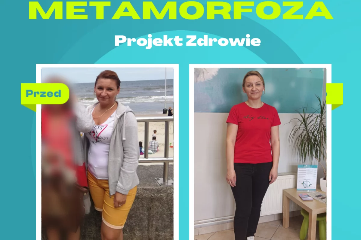 Poznajcie Panią Zuzannę, która schudła 10 kg w Gabinecie Projekt Zdrowie.