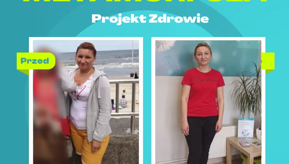 Poznajcie Panią Zuzannę, która schudła 10 kg w Gabinecie Projekt Zdrowie. - zdjęcie 1