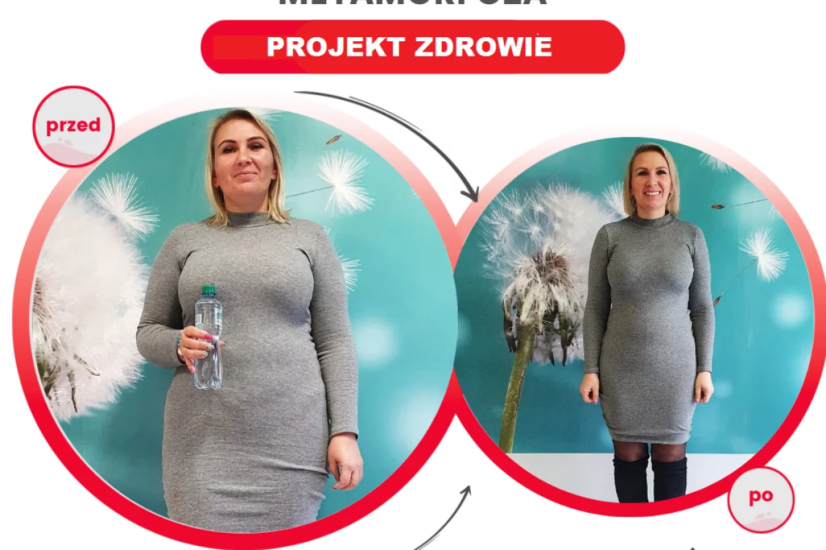 Niesamowita metamorfoza w gabinecie Projekt Zdrowie- Pani Ania schudła 15 kg!