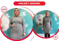 Niesamowita metamorfoza w gabinecie Projekt Zdrowie- Pani Ania schudła 15 kg! - zdjęcie główne
