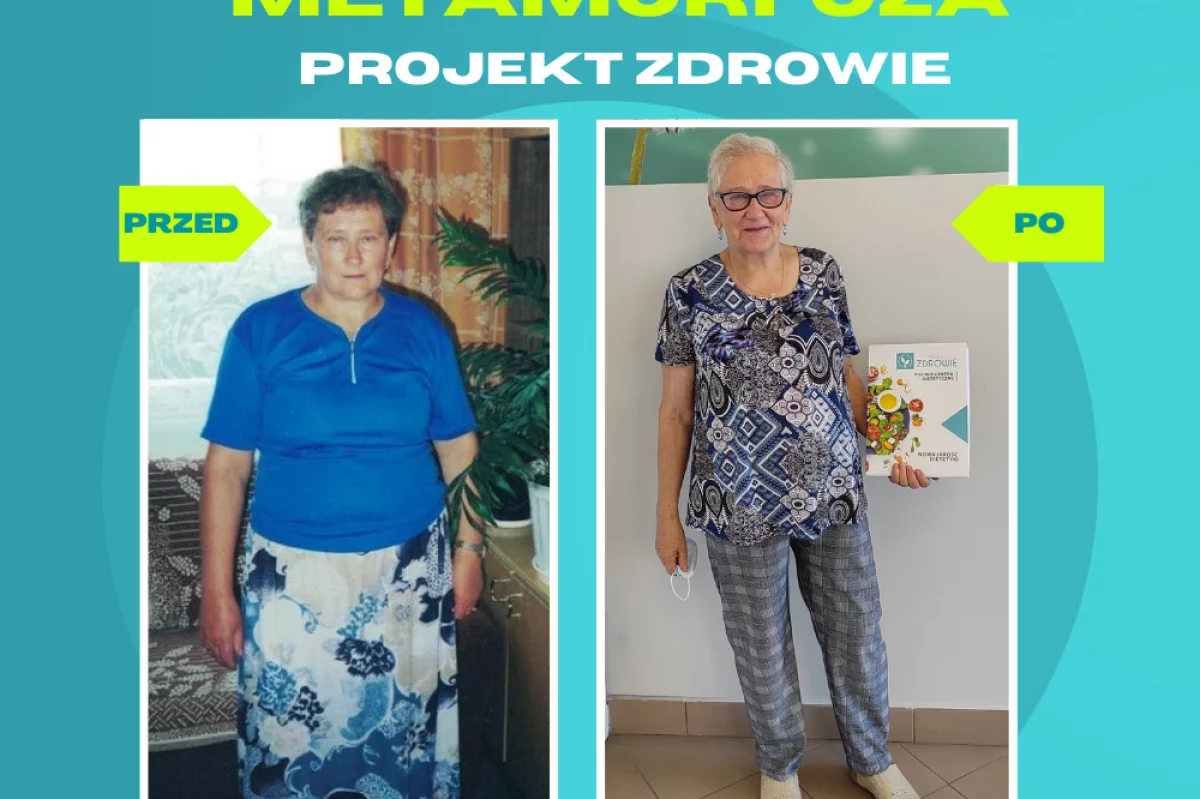 Pani Stanisława schudła 10 kg w Projekt Zdrowie!