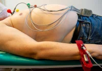 Migotanie przedsionków zwiększa ryzyko przedwczesnego zgonu, wymaga leczenia - zdjęcie główne