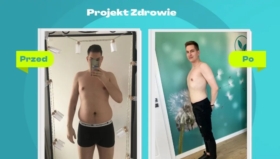 Niesamowita metamorfoza w gabinecie Projekt Zdrowie – Pan Aleksander schudł 12 kg! - zdjęcie 1