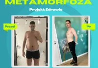 Niesamowita metamorfoza w gabinecie Projekt Zdrowie – Pan Aleksander schudł 12 kg! - zdjęcie główne